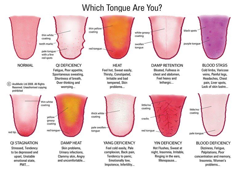 Acupuncture Chart Female