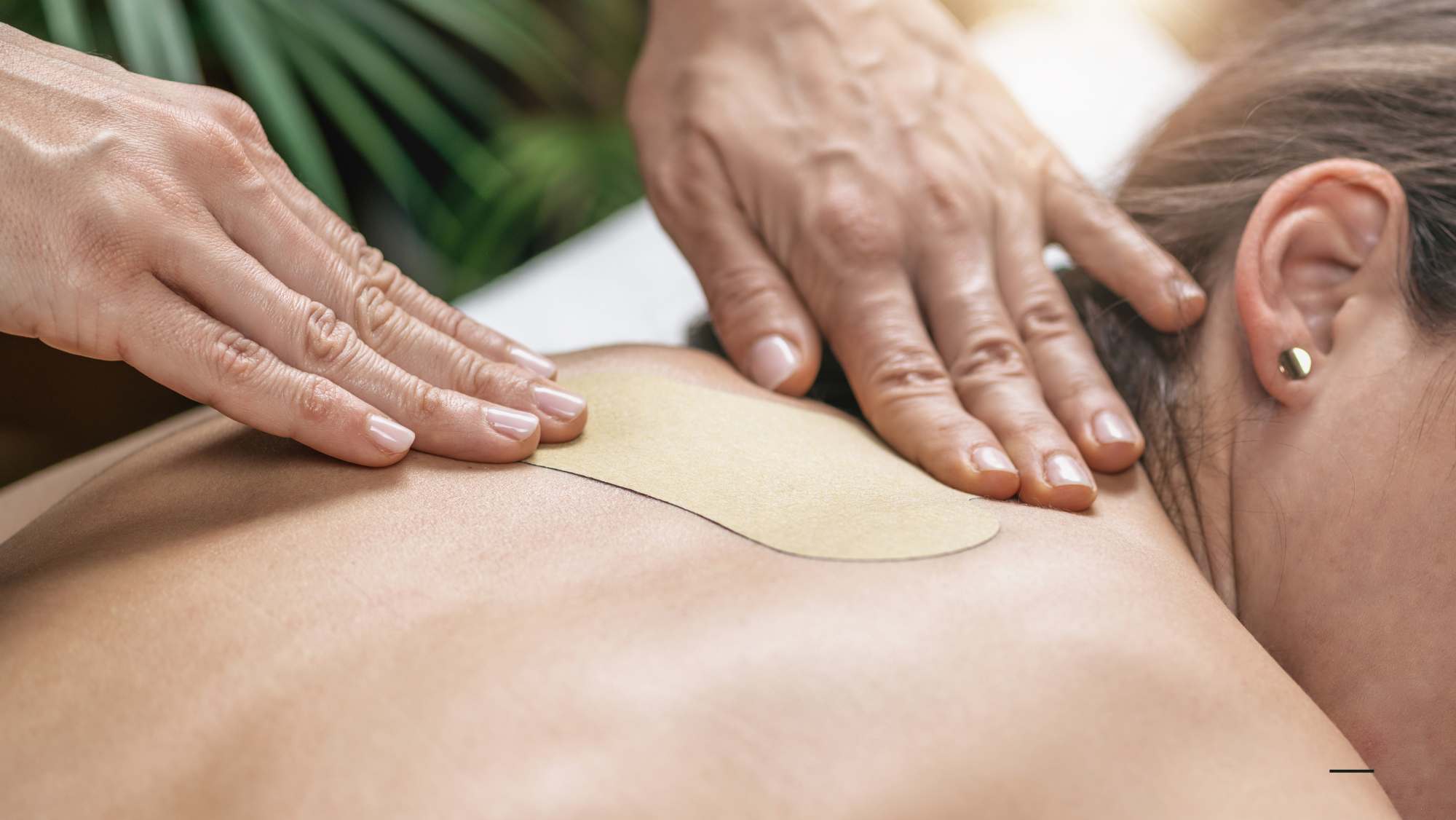 San-Fu-Tie Acupuncture Treatment During the Dog Days of Summer